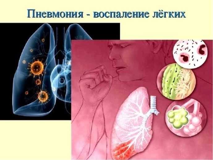 Всемирный день борьбы с пневмонией